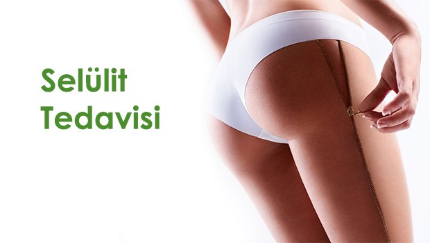 Cellulite Treatment